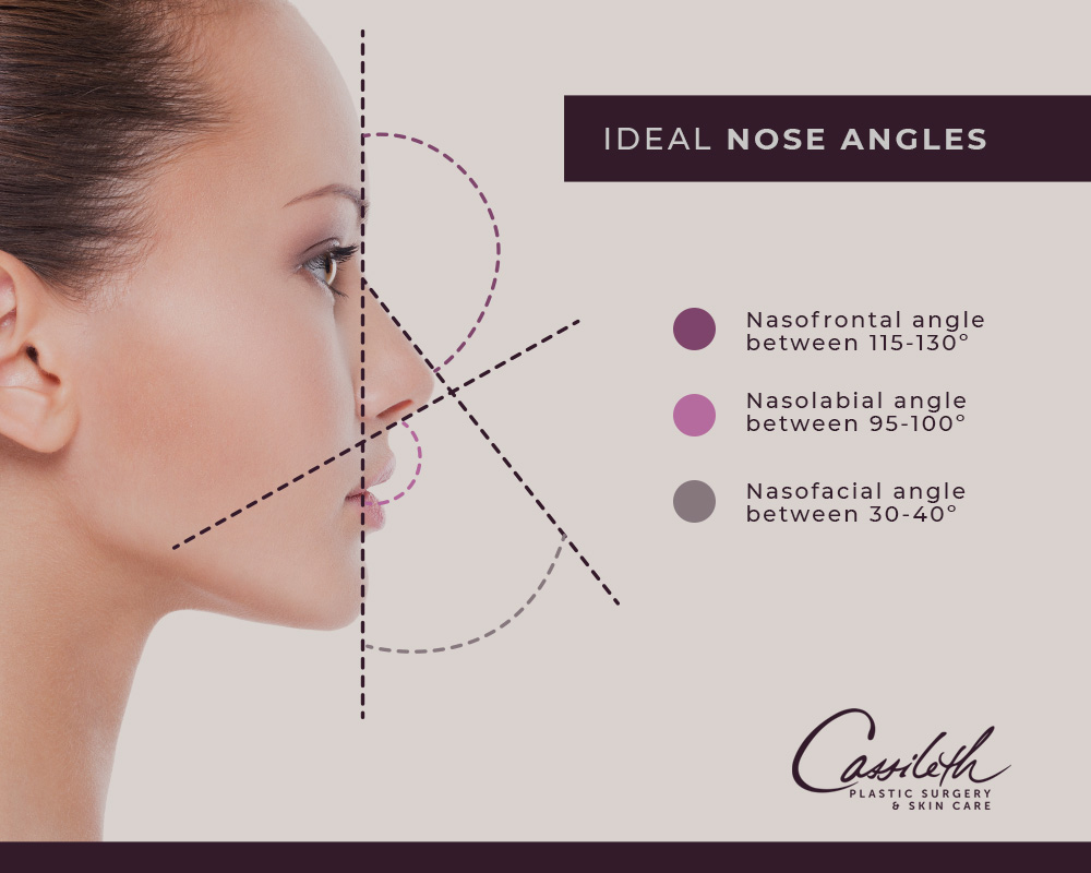For rhinoplasty at Los Angeles' Cassileth Plastic Surgery, your plastic surgeon will determine your unique ideal nose angles to correct asymmetries.