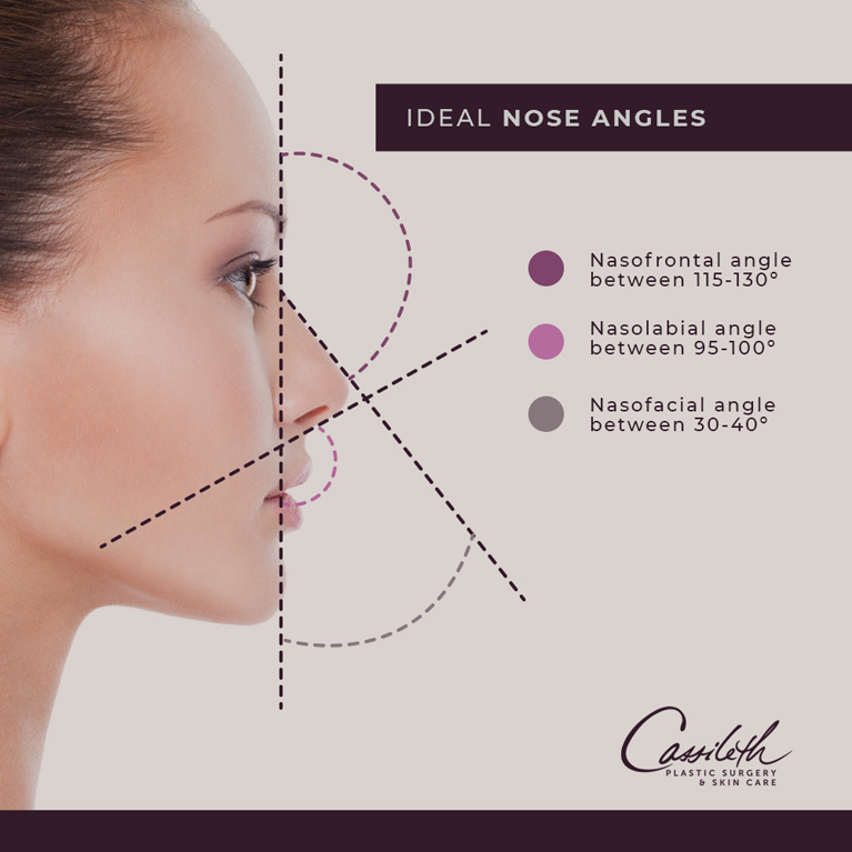 For rhinoplasty at Los Angeles' Cassileth Plastic Surgery, your plastic surgeon will determine your unique ideal nose angles to correct asymmetries.