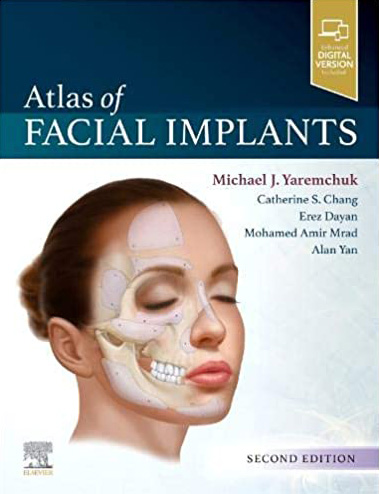 Atlas of Facial Implants