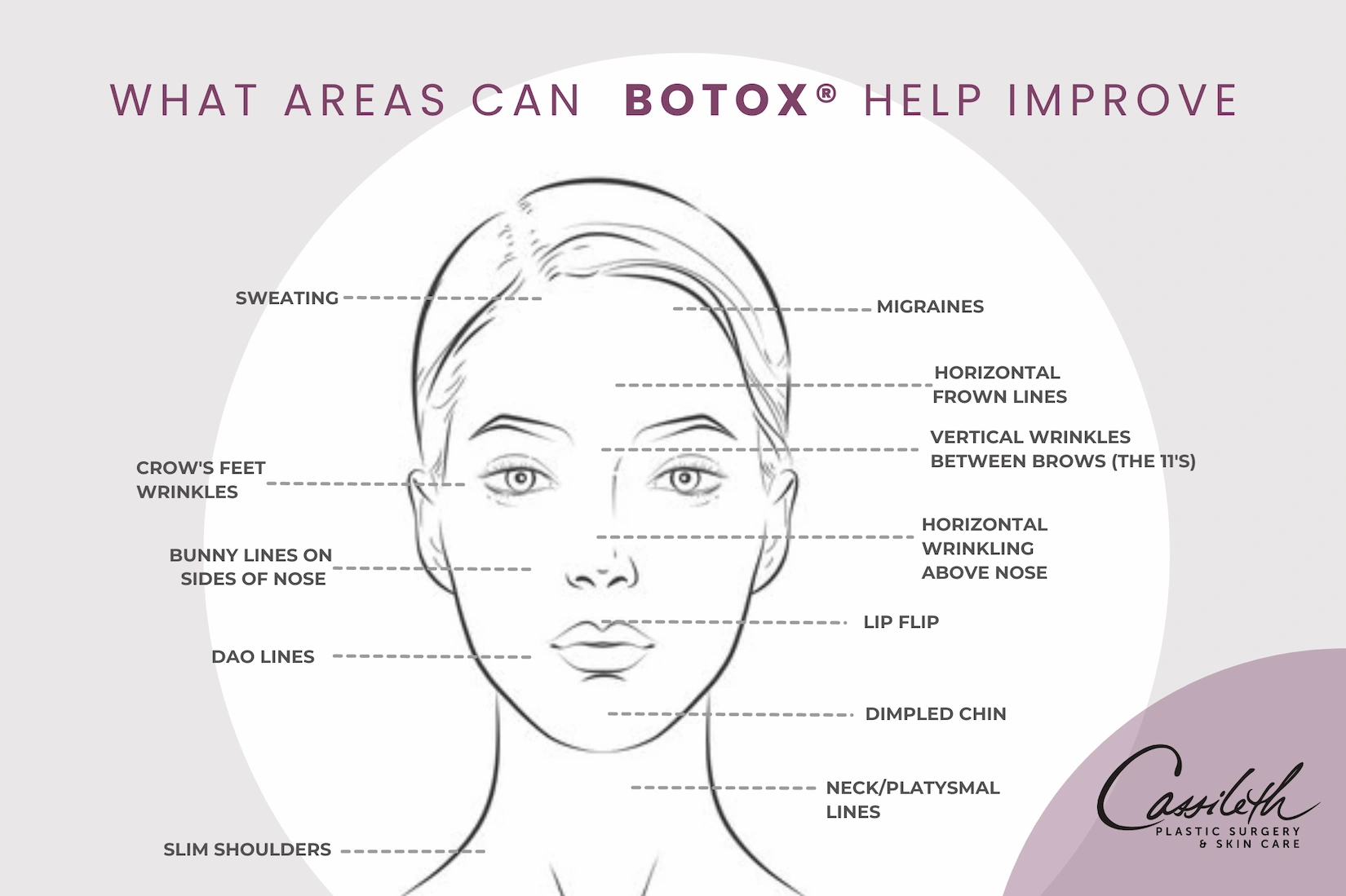 BOTOX® at Los Angeles' Cassileth Plastic Surgery is a versatile treatment that can help to improve the look of multiple facial areas.