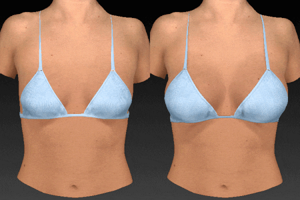 Vectra3d simulator