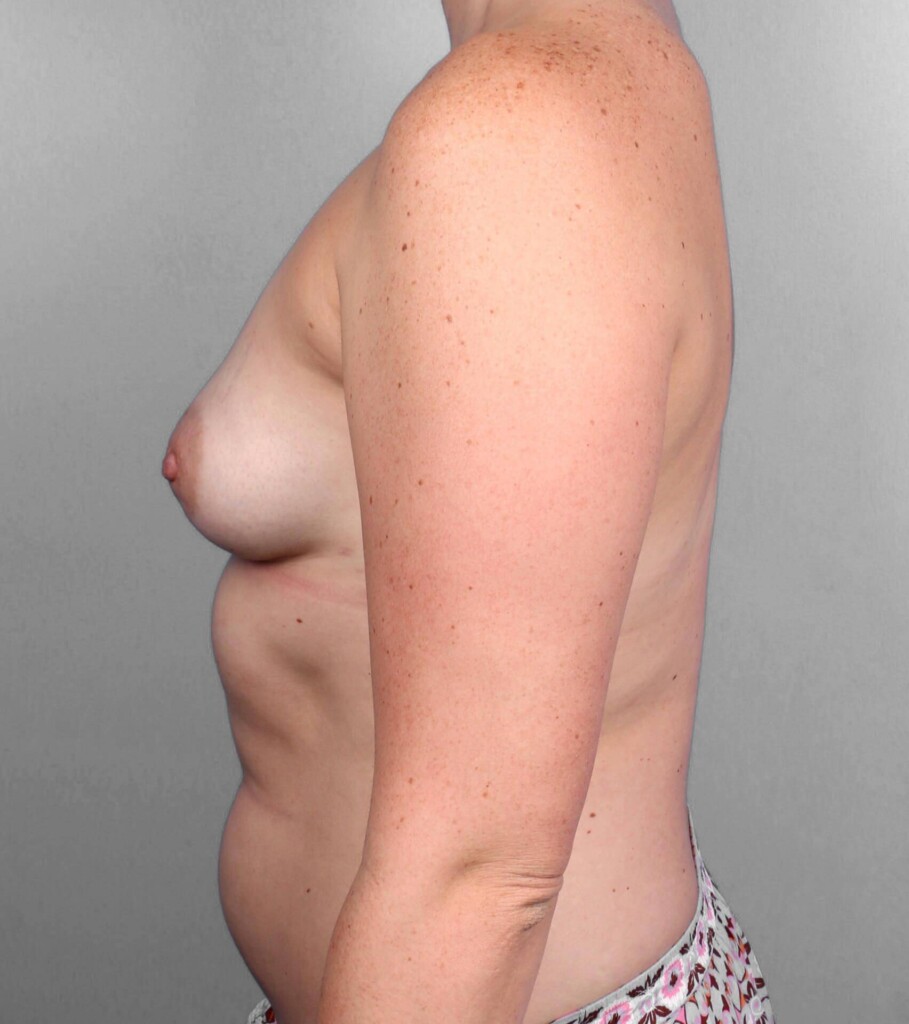 bna image