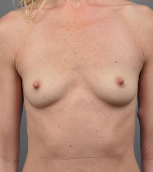 Case # 5 before photo