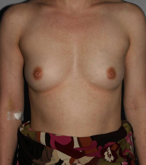 Case # 7 before photo