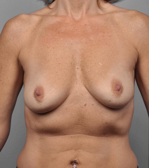 Case # 11 before photo