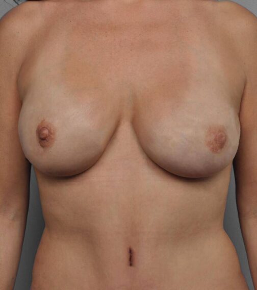 Case # 12 after photo