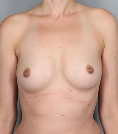 Case # 15 before photo