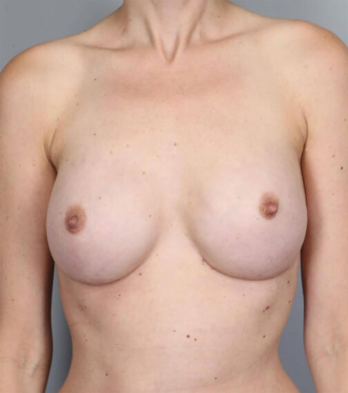 Case # 15 after photo