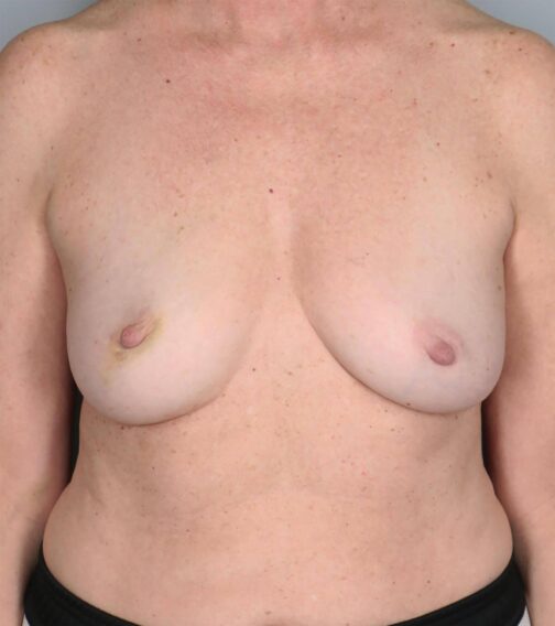 Case # 16 before photo