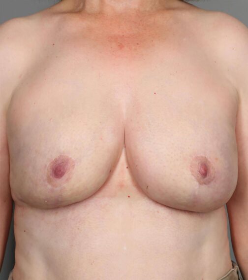 Case # 18 after photo