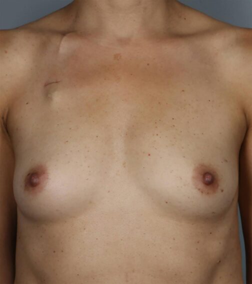 Case # 19 before photo