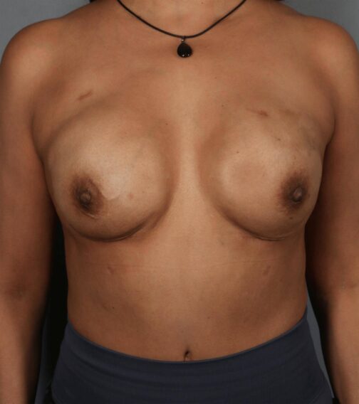 Case # 20 after photo