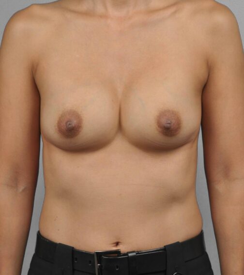 Case # 5 before photo