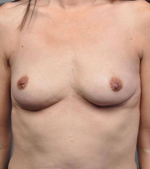 Case # 6 after photo