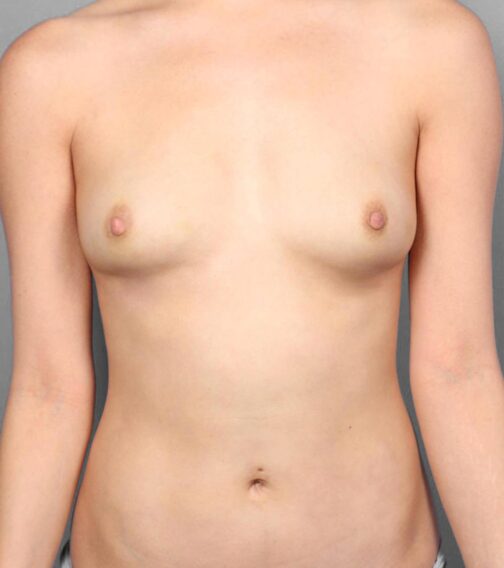 Case # 9 after photo