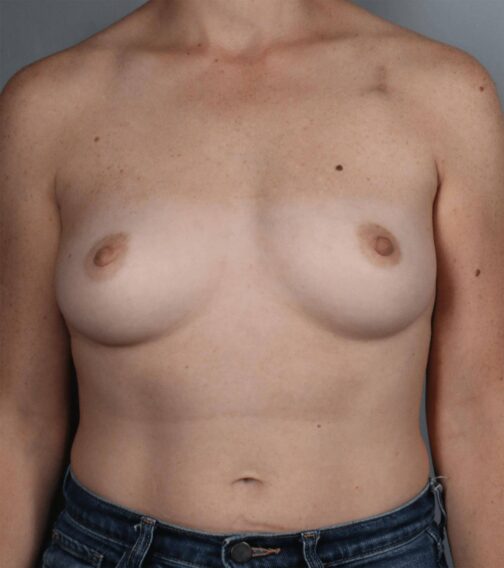 Case # 21 before photo