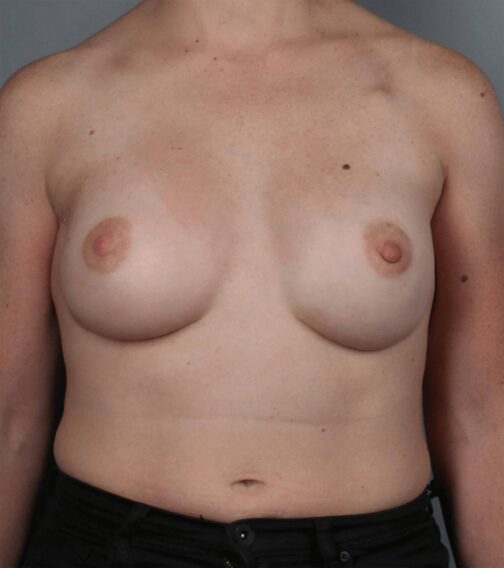 Case # 21 after photo