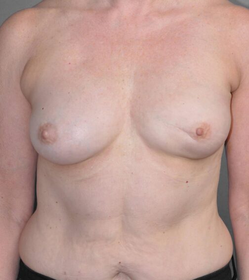 Case # 6 before photo