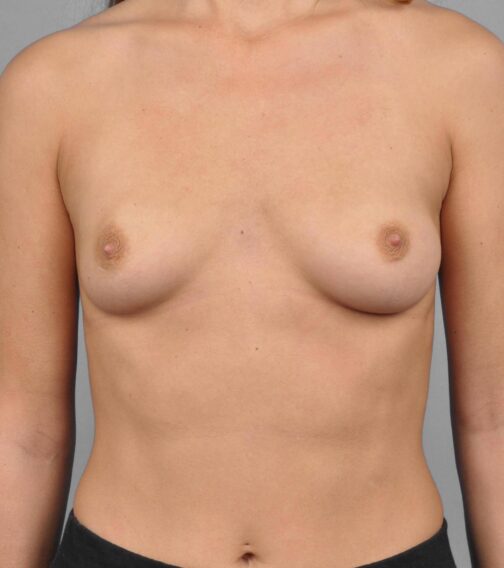 Case # 1 before photo