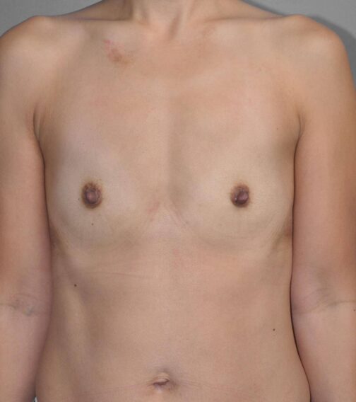 Case # 7 before photo