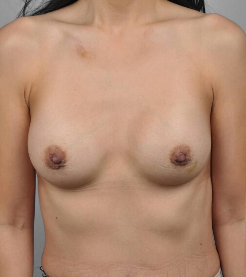 Case # 7 after photo