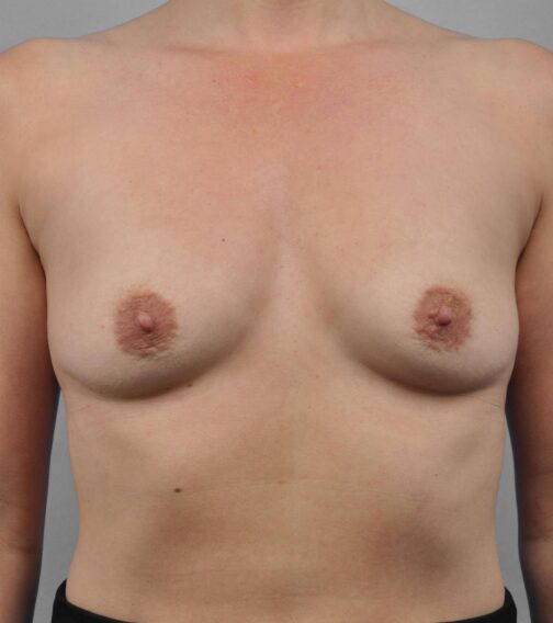 Case # 8 before photo