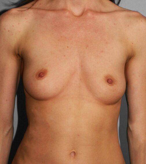 Case # 9 before photo