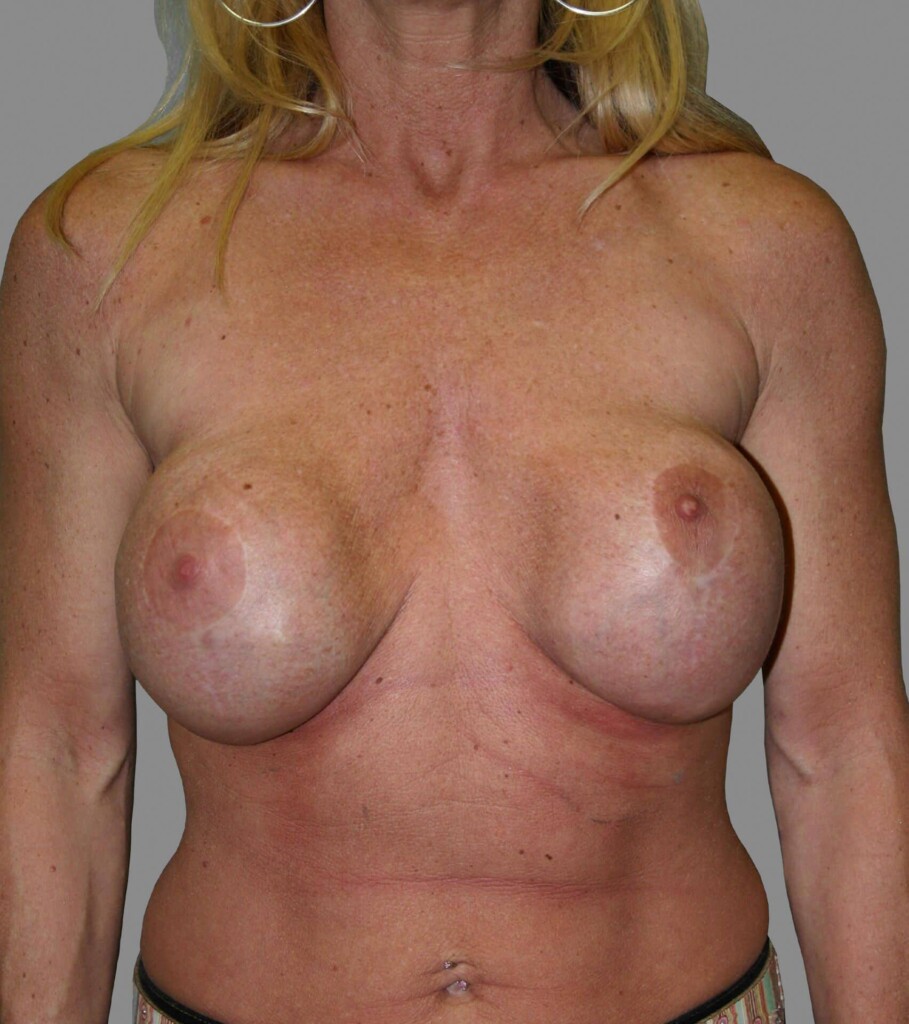 bna image