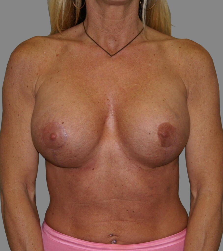 bna image