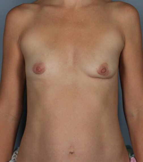 Case # 1 before photo