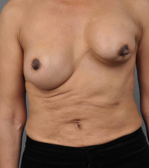 Case # 2 before photo