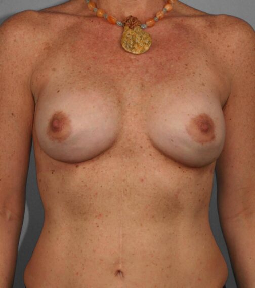 Case # 3 after photo