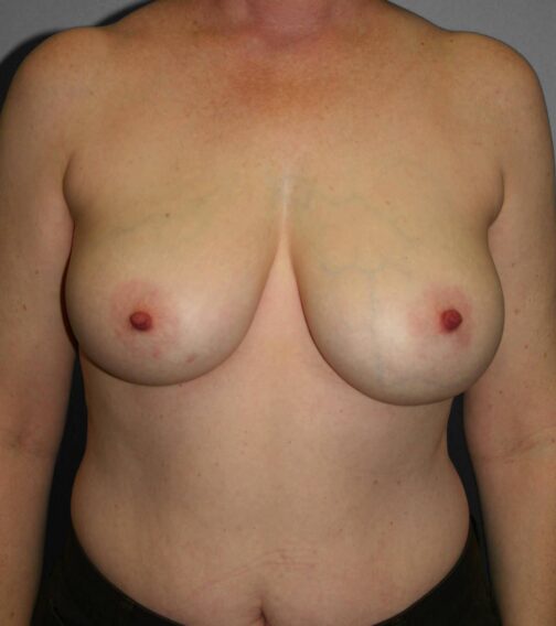 Case # 7 before photo