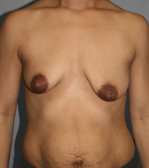 Case # 9 before photo