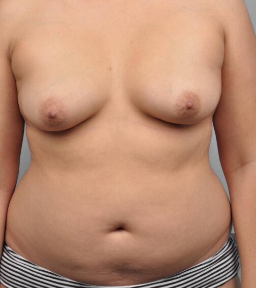 Case # 1 before photo