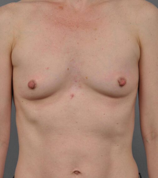 Case # 2 before photo