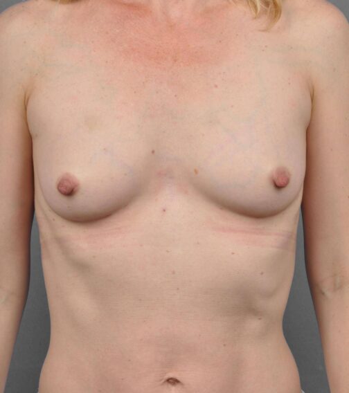 Case # 2 after photo