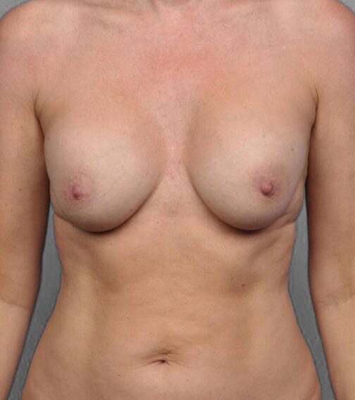 Case # 4 before photo