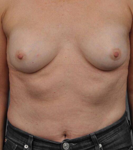 Case # 6 before photo