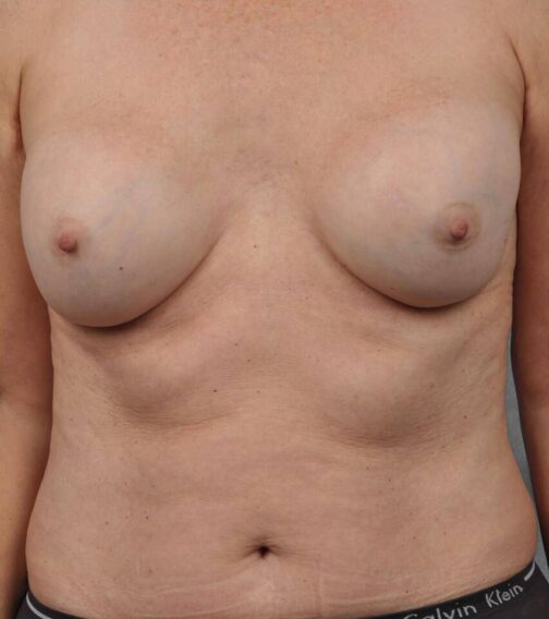 Case # 6 after photo