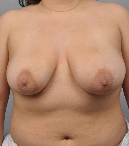 Case # 8 before photo