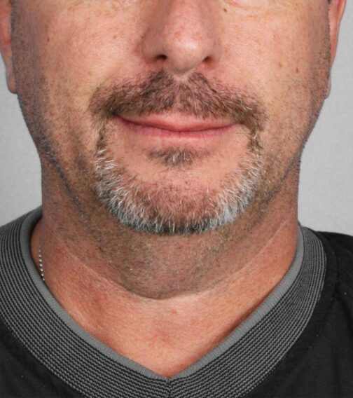 Case # 3 before photo