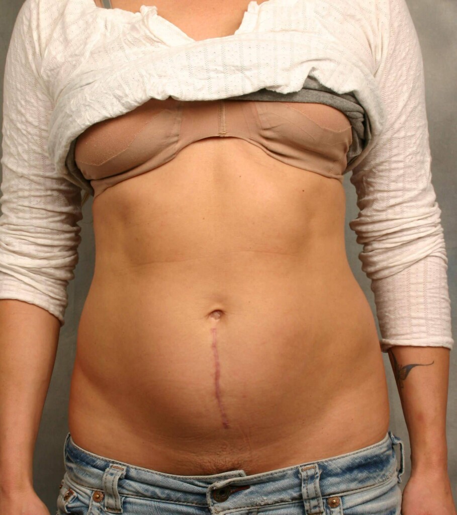 before and after gallery image