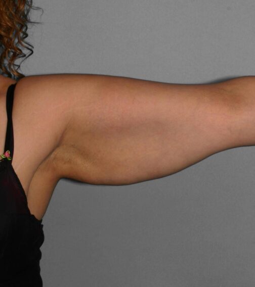 Case # 7 before photo