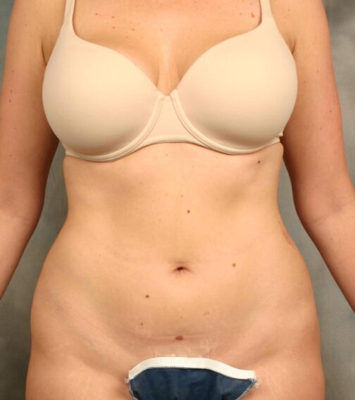 Case # 8 before photo