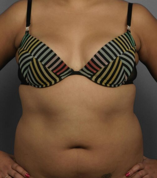 Case # 10 before photo