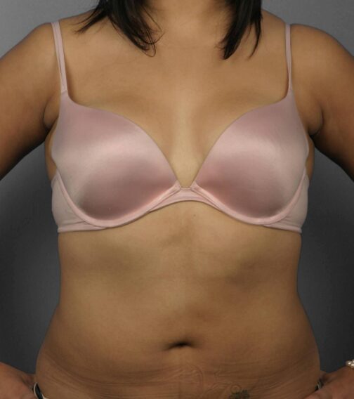 Case # 10 after photo