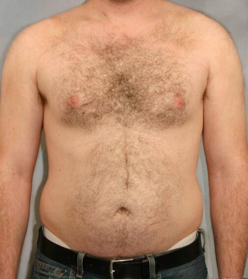 Case # 11 before photo