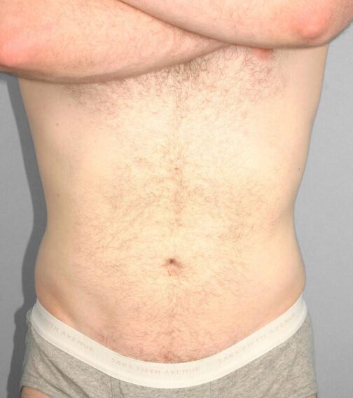 Case # 11 after photo