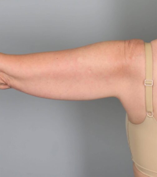 Case # 12 before photo